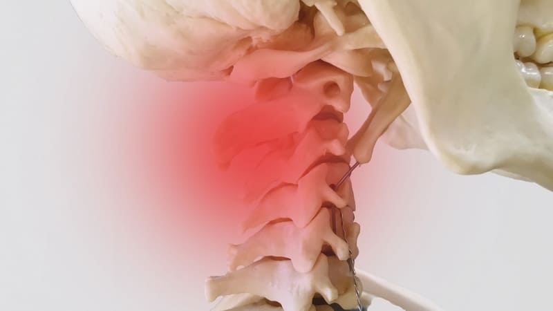 首こり・頚部痛のイメージ