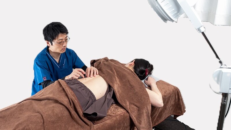 腰部のトリガーポイント鍼治療の様子